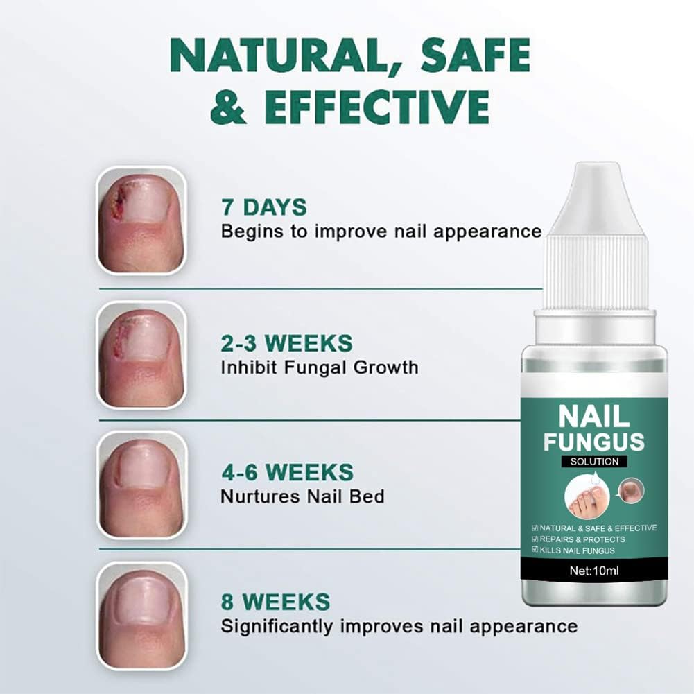 Nail fungus solution