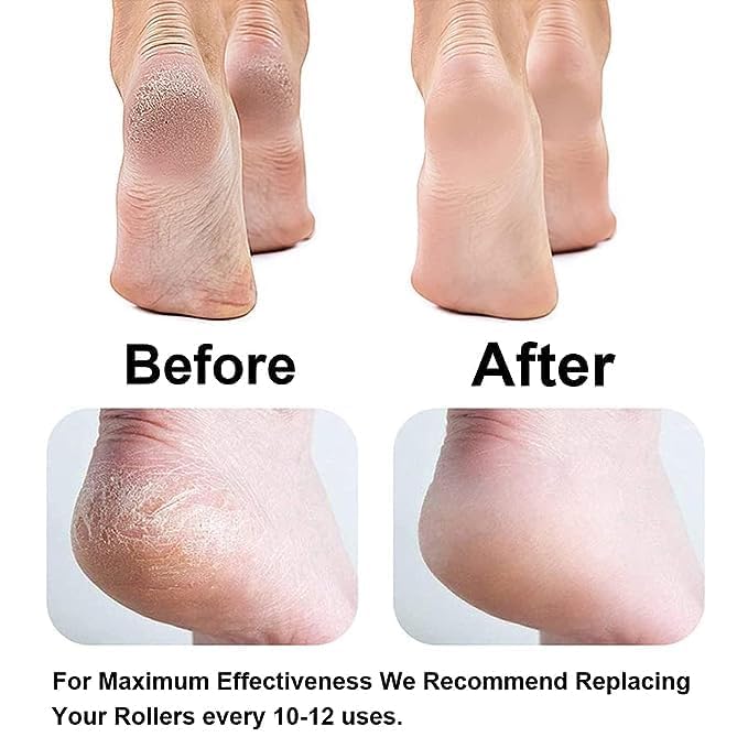 Flawless Pedi Foot Pedicure & Callus Remover