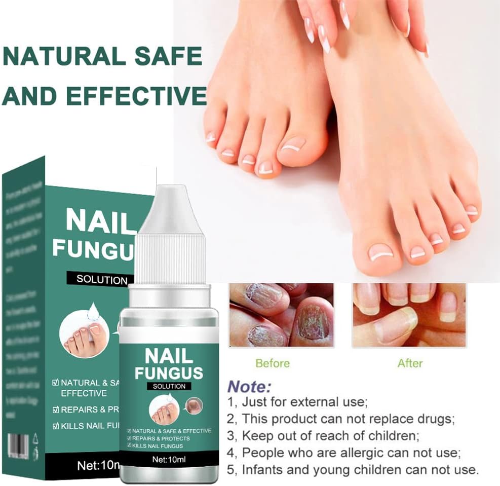Nail fungus solution