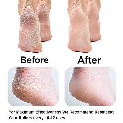 Flawless Pedi Foot Pedicure & Callus Remover